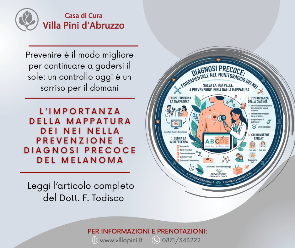 L’importanza della mappatura dei nei: prevenzione e diagnosi precoce del melanoma
